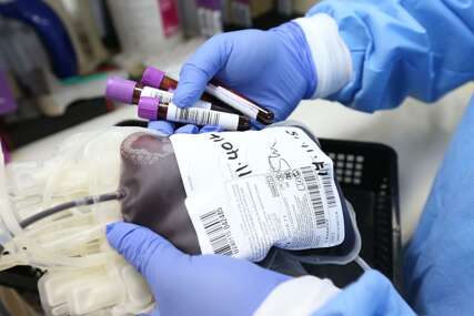 Tri važna razloga zbog kojih je darovanje krvi dobro za naše tijelo