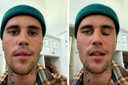 Justin Bieber objavio da boluje od rijetkog sindroma: 'Pola lica mi je potpuno paralizirano'