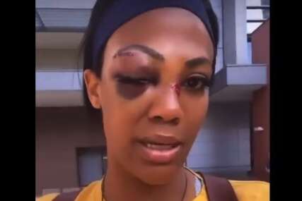 Možda zato što je prelijepa: Beskućnik brutalno napao slavnu američku sportistkinju, posljedice pokazala u videu