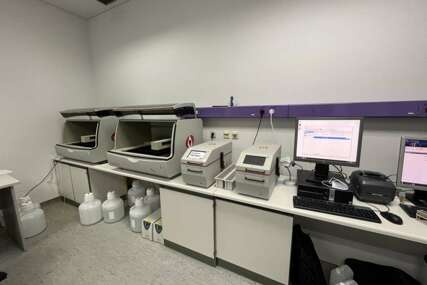 Na KCUS-u instalirani novi aparati za brže dobijanje patohistoloških nalaza