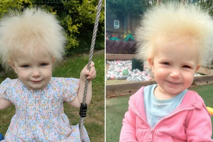 Upoznajte djevojčicu sa sindromom nečešljive kose: Njene plave vlasi jednostavno je nemoguće dovesti u red 