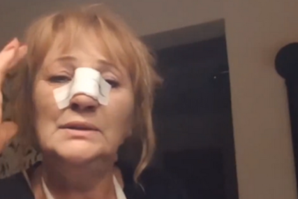 Jeziva ispovijest žene iz Novog Travnika: Šef joj dao otkaz, pa joj slomio nos i ruku