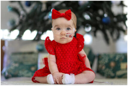 Djevojčica rođena s organima izvan tijela je dočekala svoj prvi Božić
