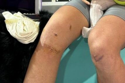 Ovo su koljena nekada najtalentovanijeg fudbalera Barcelone: Povrede mu uništile karijeru