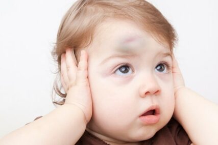 Mala djeca se često udare u glavu. U ovim slučajevima ih obavezno odvedite doktoru