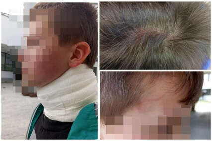 Užas u Sarajevu: 9-godišnjaka fizički napala majka dječaka iz njegovog razreda