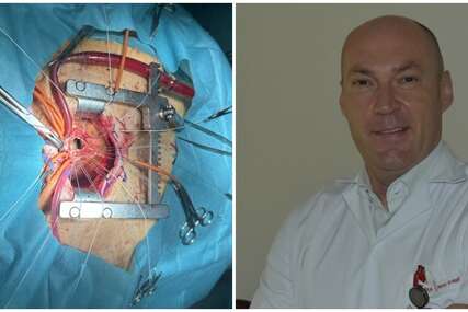 U Tuzli uspješno izveden operativni zahvat zamjene aortne valvule i aneurizme početnog dijela aorte