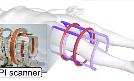 Bez zračenja: Novi skener za ljudsko tijelo