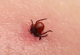 Kako izvaditi krpelja ako ste daleko od ambulante