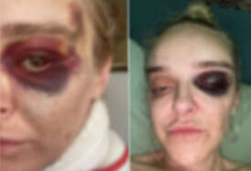 UŽAS U SARAJEVU: Radnik na parkingu brutalno pretukao mladu doktoricu