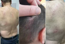 „I mene su tukli, pa šta mi fali“: Psihologinja objašnjava zašto batine nisu odgoj