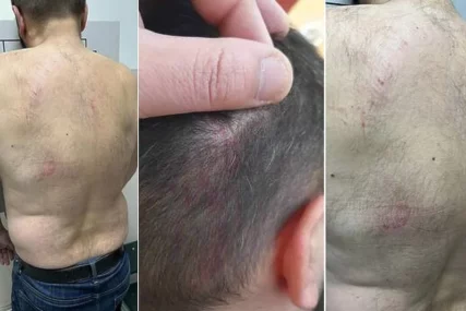 „I mene su tukli, pa šta mi fali“: Psihologinja objašnjava zašto batine nisu odgoj