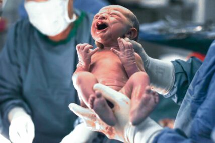 Pokazalo istraživanje: Bebe rođene carskim rezom podložnije su hospitalizaciji zbog infekcija