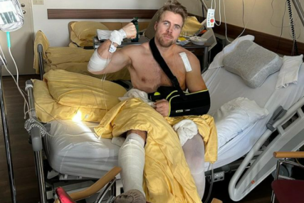 Uznemirujući sadržaj: Jedan od najboljih skijaša objavio fotografije rasparane noge nakon teškog pada