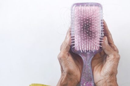 Šest uzroka opadanja kose: Maslinovo ulje, ravnanje, pogrešno sušenje…