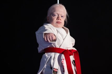 albino djevojcica turska