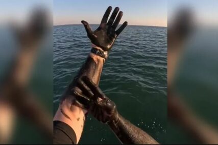 POTEZ "MAJSTORA" Namazao je ruke tintom iz lignje pa se čudio posljedicama (VIDEO)