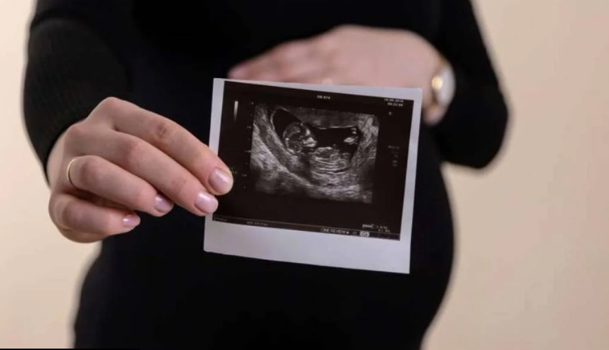 trudnoca fetus ultrazvuk