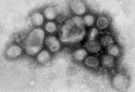 Australija potvrdila prvi slučaj ptičije gripe H5N1 kod domaće morske ptice