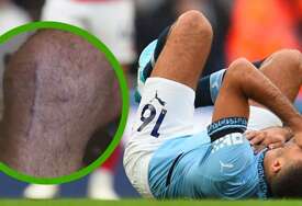 U Manchester Cityju zabrinuti: Rodrijev oporavak ne ide prema planu