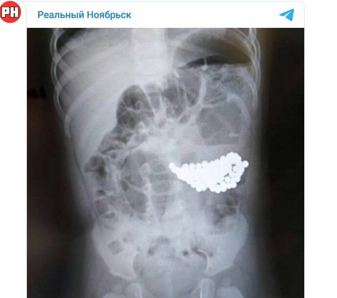 FOTO: TELERGAM