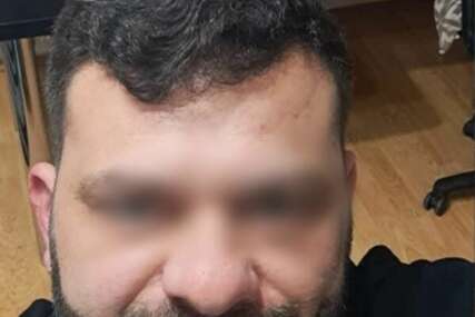 Samir iz Zavidovića o usmrtio psa, a onda se javno hvalio time