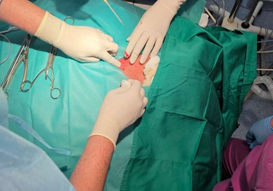 FOTO: KLINIČKI CENTAR CG