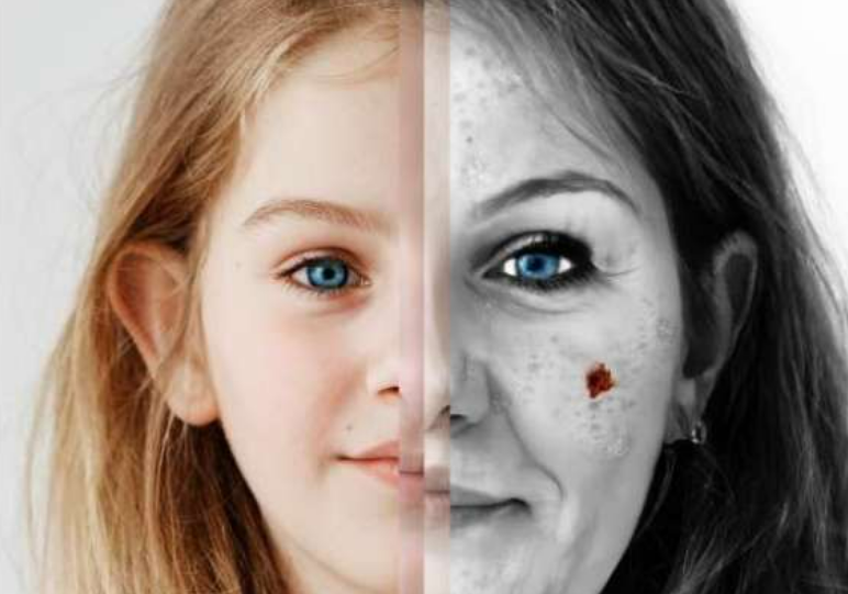 FOTO: EUROMELANOMA