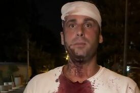 Oglasio se pretučeni zastupnik: "Kad vlast angažuje SNS huligane da brutalno tuku građane, to je slom države"