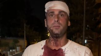 Oglasio se pretučeni zastupnik: "Kad vlast angažuje SNS huligane da brutalno tuku građane, to je slom države"
