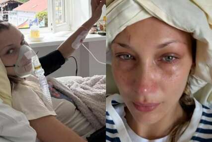 Bella Hadid izazvala zabrinutost objavom fotografija iz bolničkog kreveta
