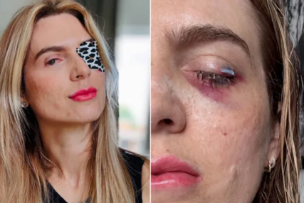 Popila tabletu protiv bolova pa završila u komi i izgubila vid: "Tijelo mi je gorjelo iznutra"