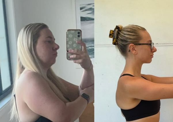 FOTO: INSTAGRAM / DILSHEALTH
