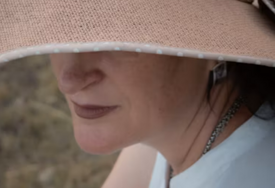 Imate tamne mrlje na licu: Evo kako ih možete ublažiti