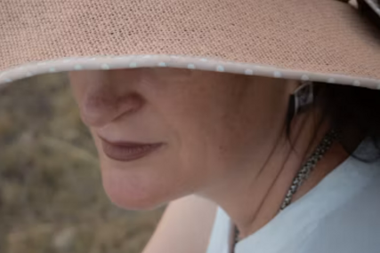Imate tamne mrlje na licu: Evo kako ih možete ublažiti