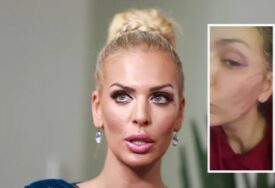 Skandal trese region: Ava Karabatić nakon nasilja otkrila šokantne detalje