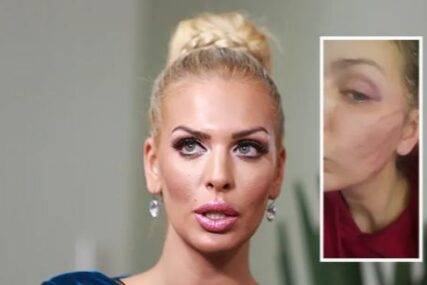 Skandal trese region: Ava Karabatić nakon nasilja otkrila šokantne detalje