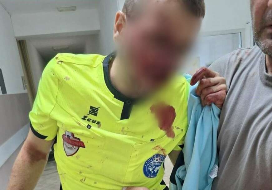 FOTO: POLICIJA BRČKO