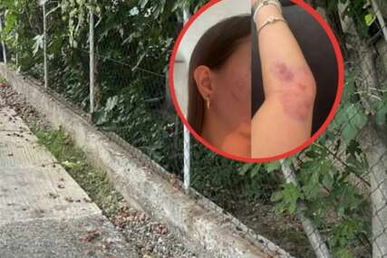 Porodica ogorčena nakon napada na djevojku u Modriči: “Osumnjičeni pušten da se brani sa slobode”