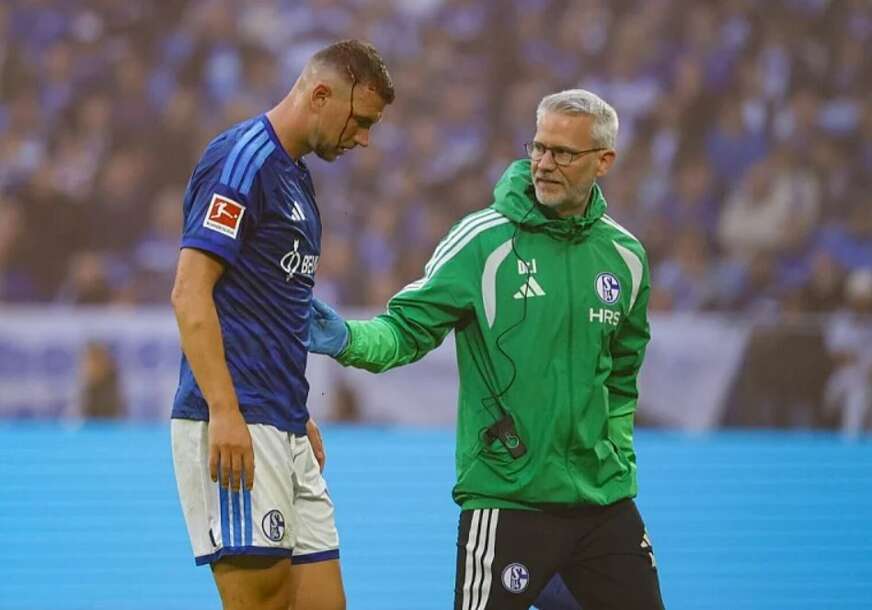FOTO: EPA